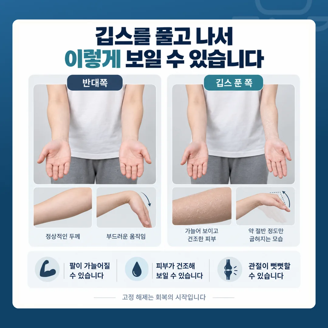 고정을 푼 뒤 팔이 반대쪽보다 가늘어지고 관절이 덜 굽는 모습을 비교한 그림