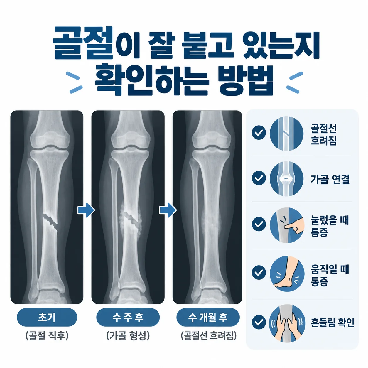 골절이 잘 붙고 있는지 영상검사와 진찰로 확인하는 항목