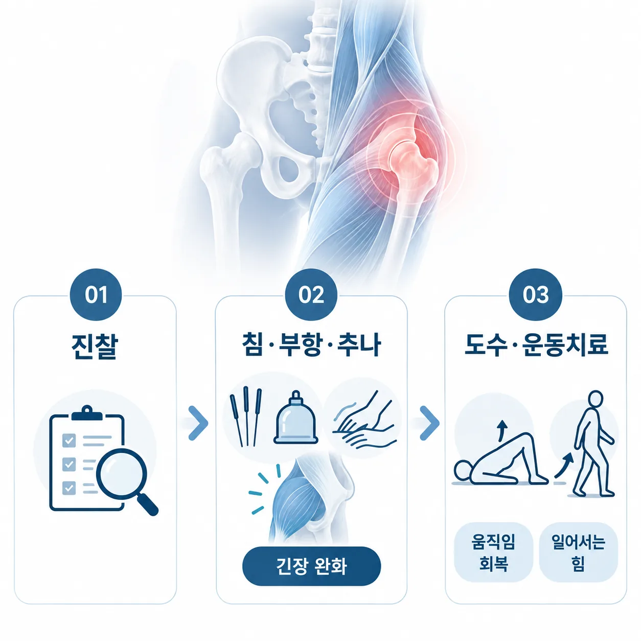고관절 통증 진찰 뒤 한방 치료와 도수치료, 운동치료로 이어지는 세 단계 진료 흐름도