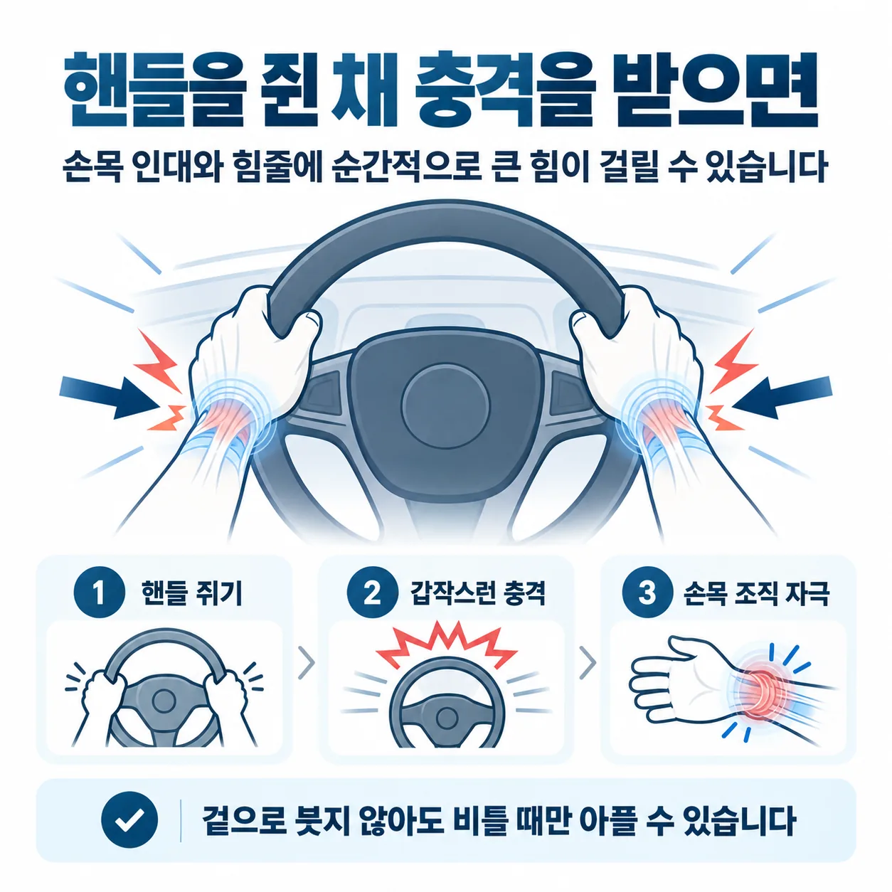 핸들을 쥔 손에 힘이 걸릴 때 손목 인대가 당겨지는 모습 개념도