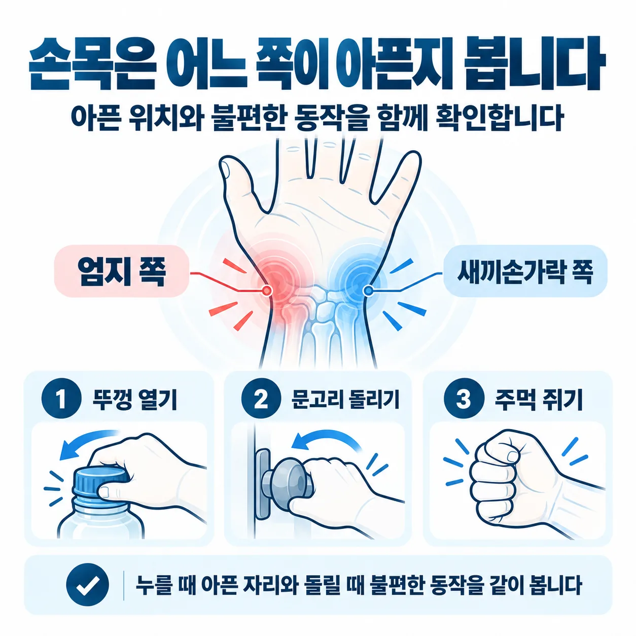 손목 엄지 쪽과 새끼손가락 쪽 위치와 진찰 때 살펴보는 세 가지 동작 그림