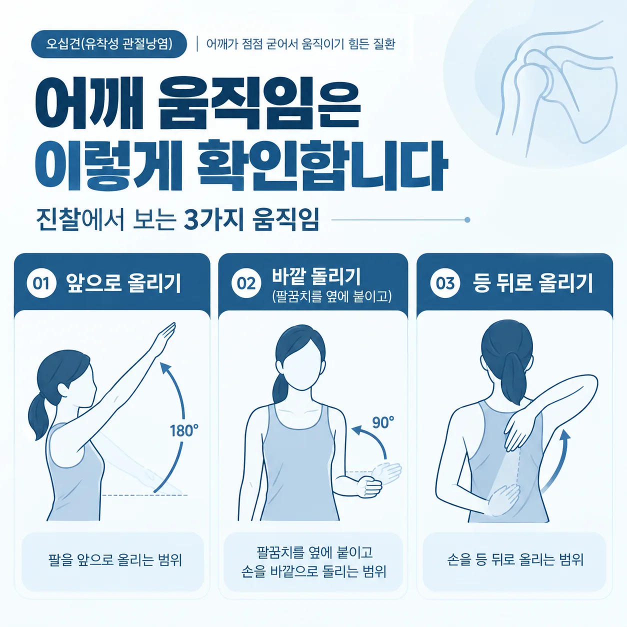 오십견 진찰에서 보는 팔 올리기 바깥 돌리기 등 뒤로 돌리기 세 가지 움직임 그림