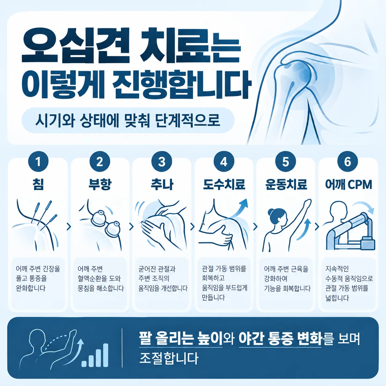 오십견 치료 차례를 번호로 표시한 어깨 그림 침 부항 추나 도수치료 운동치료 어깨 CPM