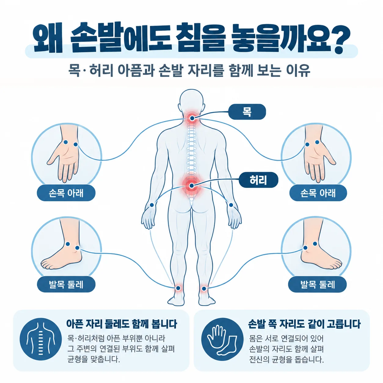 목과 허리의 아픈 자리 둘레와 손발 쪽 혈자리를 줄기로 이은 개념도